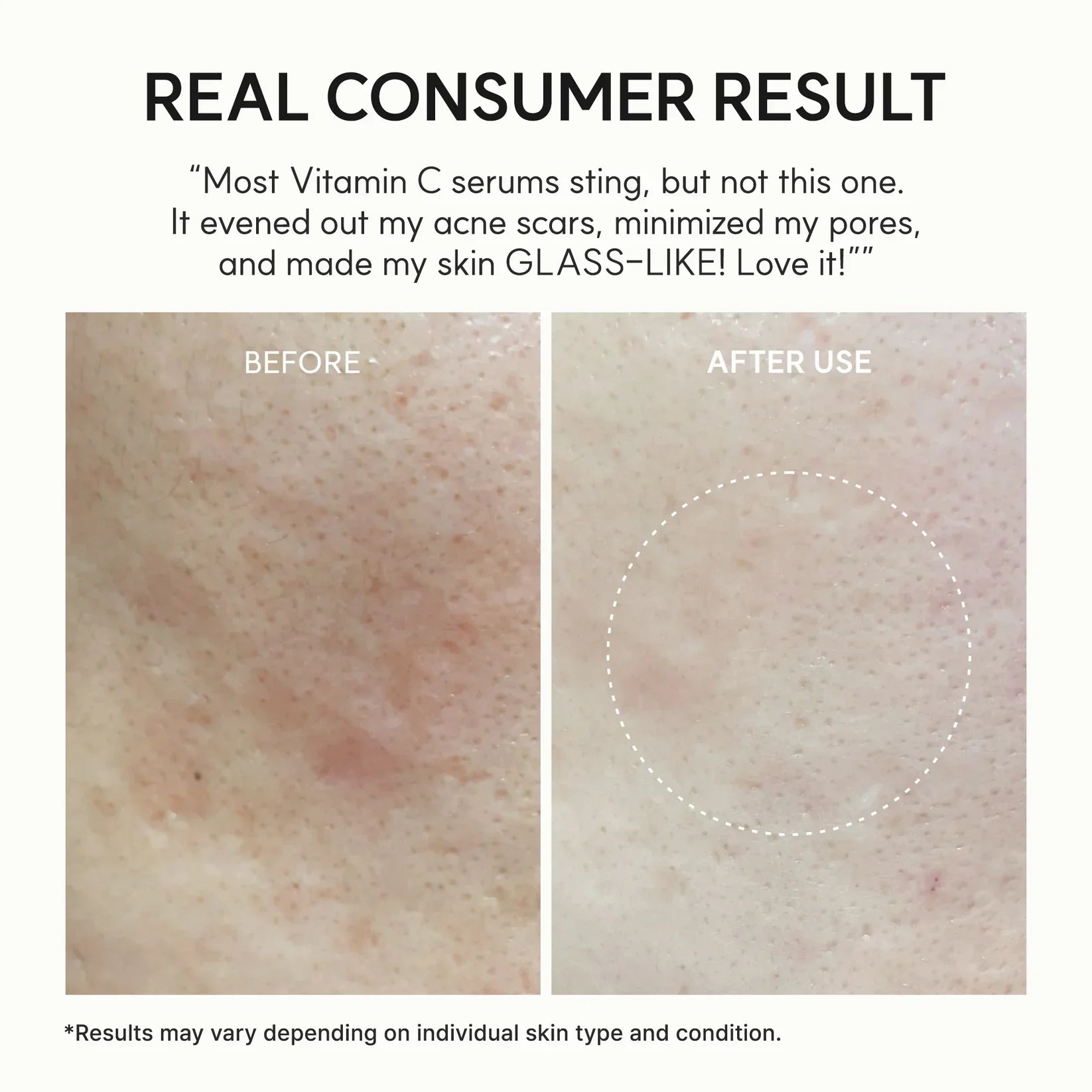 Meesue Vitamin C Booster Shot Serum with Glutathione & Pure Vitamin C