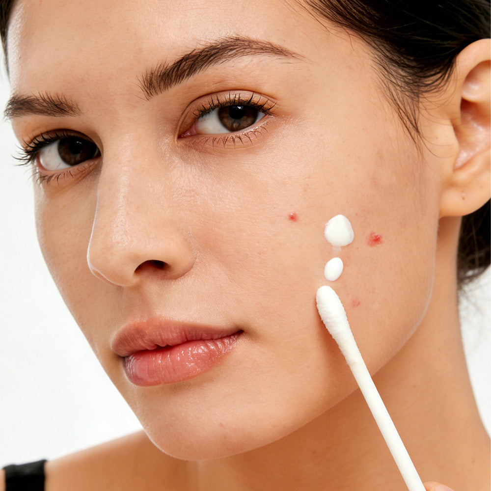 Meesue Salicylic Acid Drying Lotion with Niacinamide, Sulfur & Zinc Oxide for Acne
