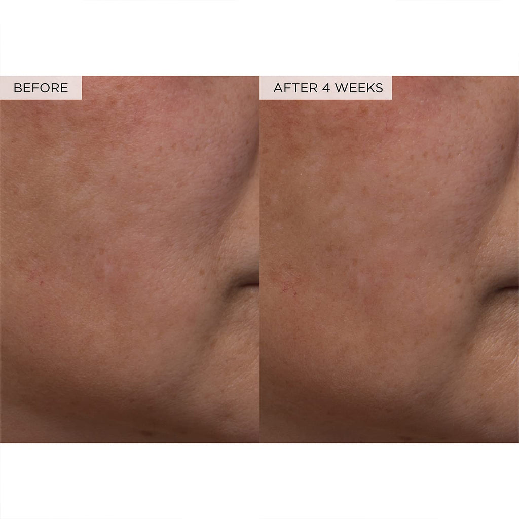Meesue PHA + BHA Pore Tight Toner with Watermelon Extract & Glycerin for Pore