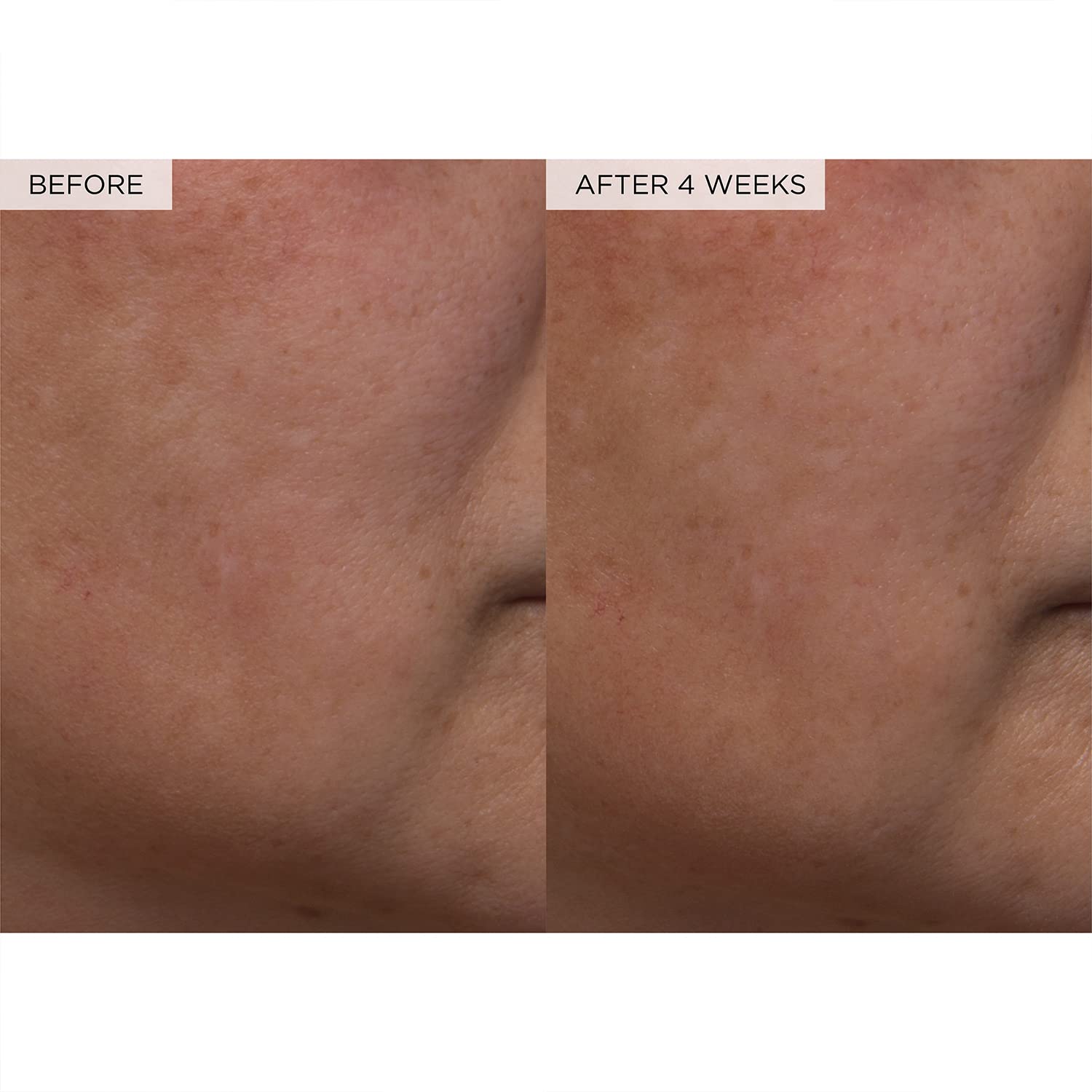 Meesue PHA + BHA Pore Tight Toner with Watermelon Extract & Glycerin for Pore
