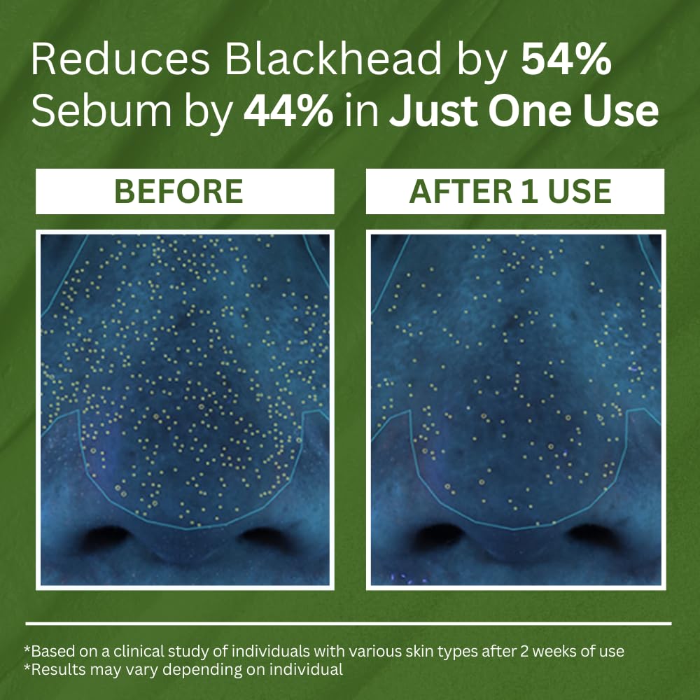 Meesue Holy Basil Bubble Deep Mask with Korean Clay & PHA for Pores, Blackheads & Blemishes