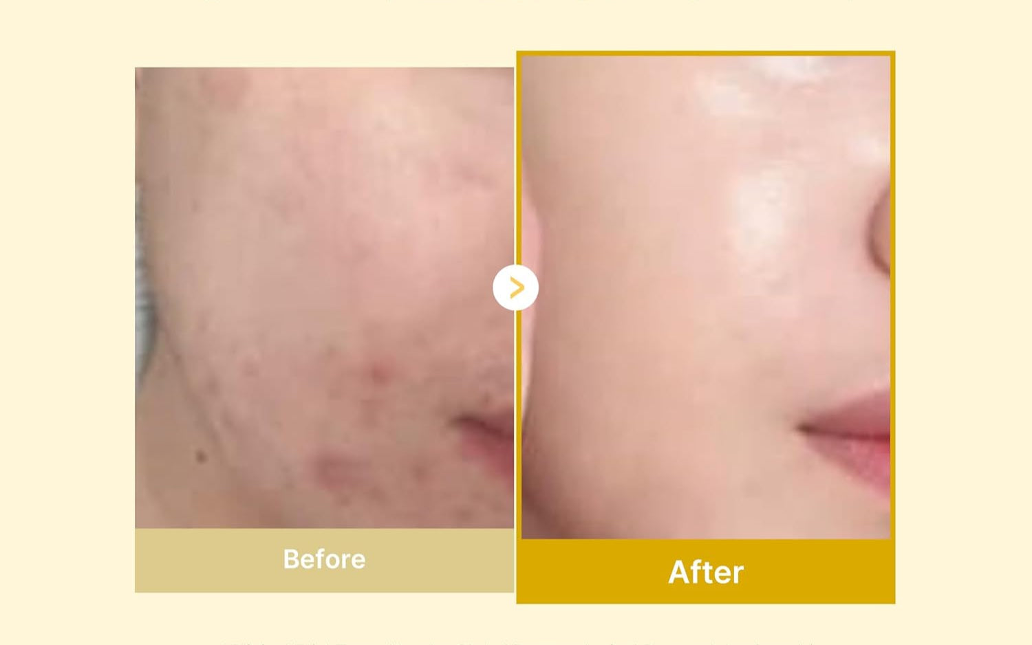 Meesue Kojic Acid & Turmeric Overnight Peel-Off Mask featuring Vitamin C & Retinol