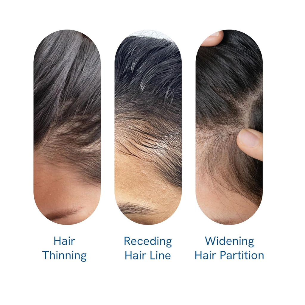 Meesue Hair Growth Serum Roll-On with Rosemary, Redensyl & Peptides