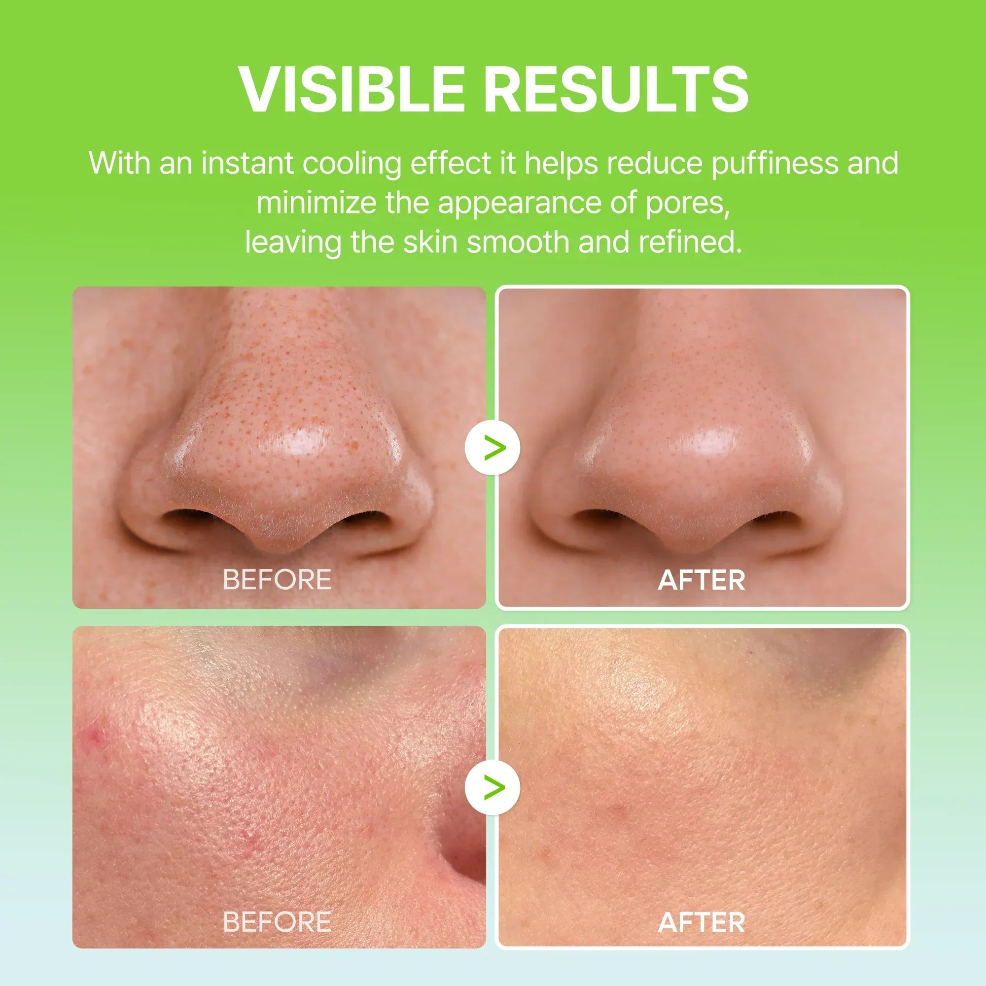 Meesue CACTOX Pore Relief Multi Balm for Pores, Puffiness & Skin Texture