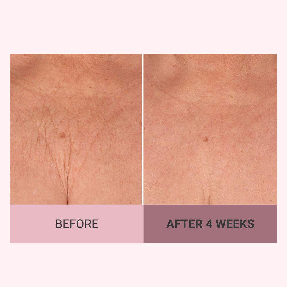 Meesue Champagne Firming Body Cream — Luxe-Lift Complex & Pink Pepperslim Firming Formula