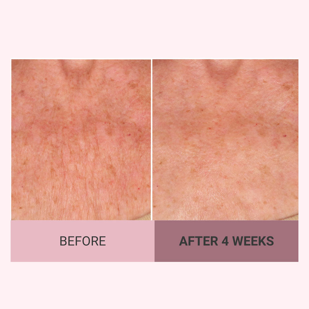 Meesue Champagne Firming Body Cream — Luxe-Lift Complex & Pink Pepperslim Firming Formula