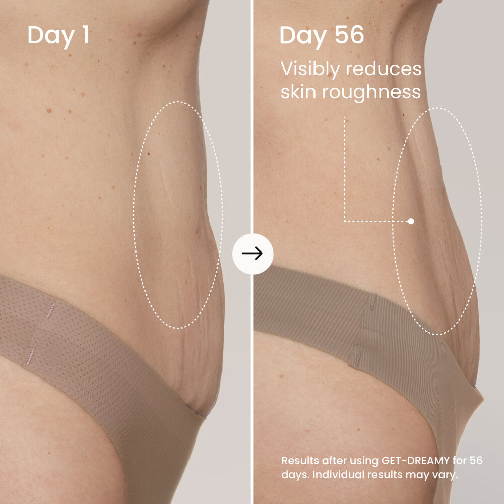 Meesue GET-DREAMY Overnight Body Whip with Caffeine, Peptides & Magnesium for Uneven Skin Texture