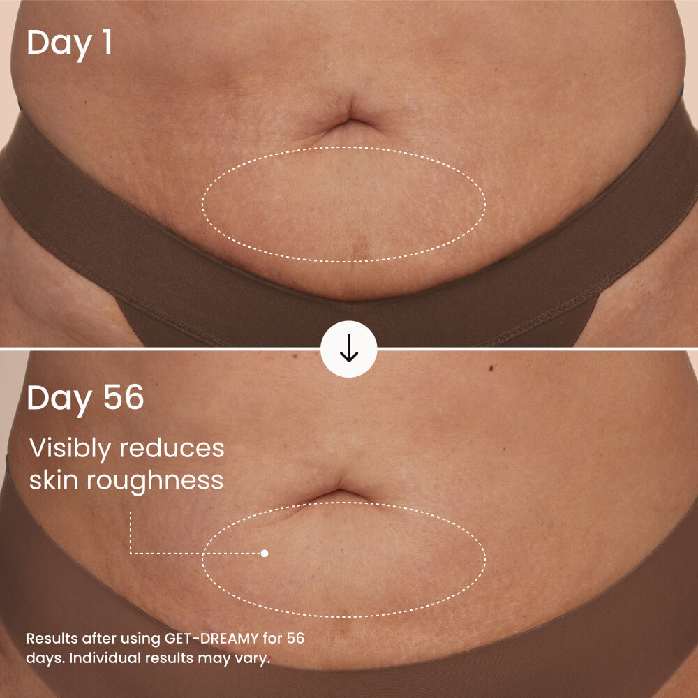 Meesue GET-DREAMY Overnight Body Whip with Caffeine, Peptides & Magnesium for Uneven Skin Texture