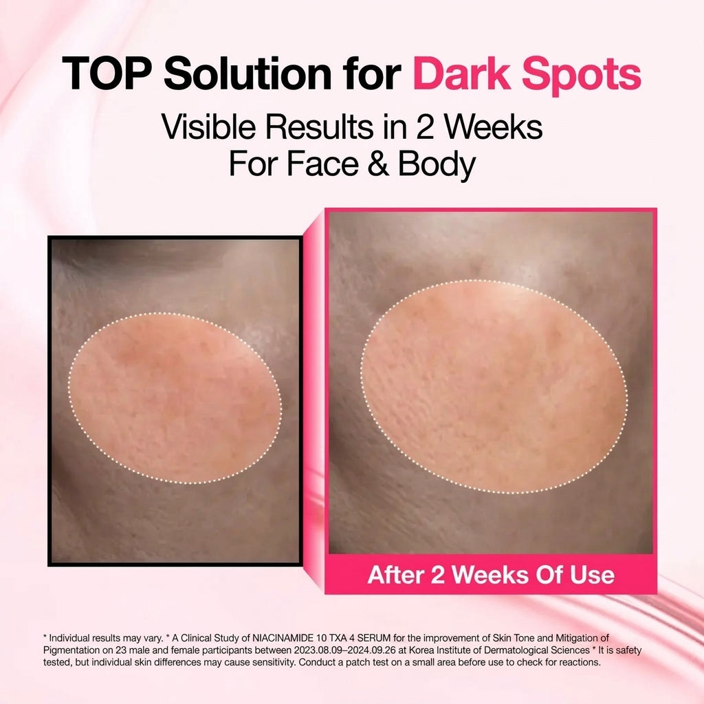 Meesue Dark Spot Brightening Serum with Niacinamide, Tranexamic Acid & Arbutin