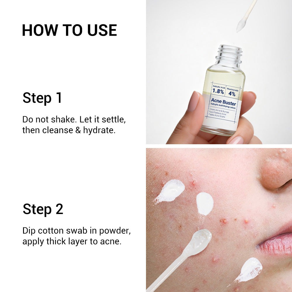 Meesue Salicylic Acid Drying Lotion with Niacinamide, Sulfur & Zinc Oxide for Acne