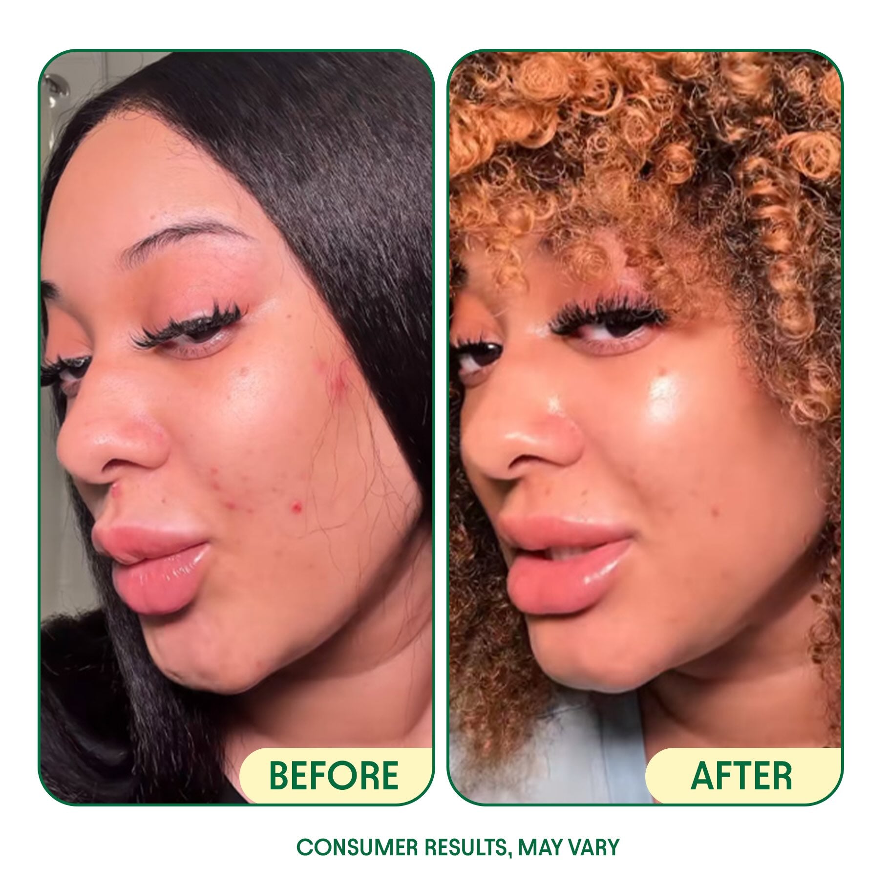 Ageless Glow Skincare Bundle