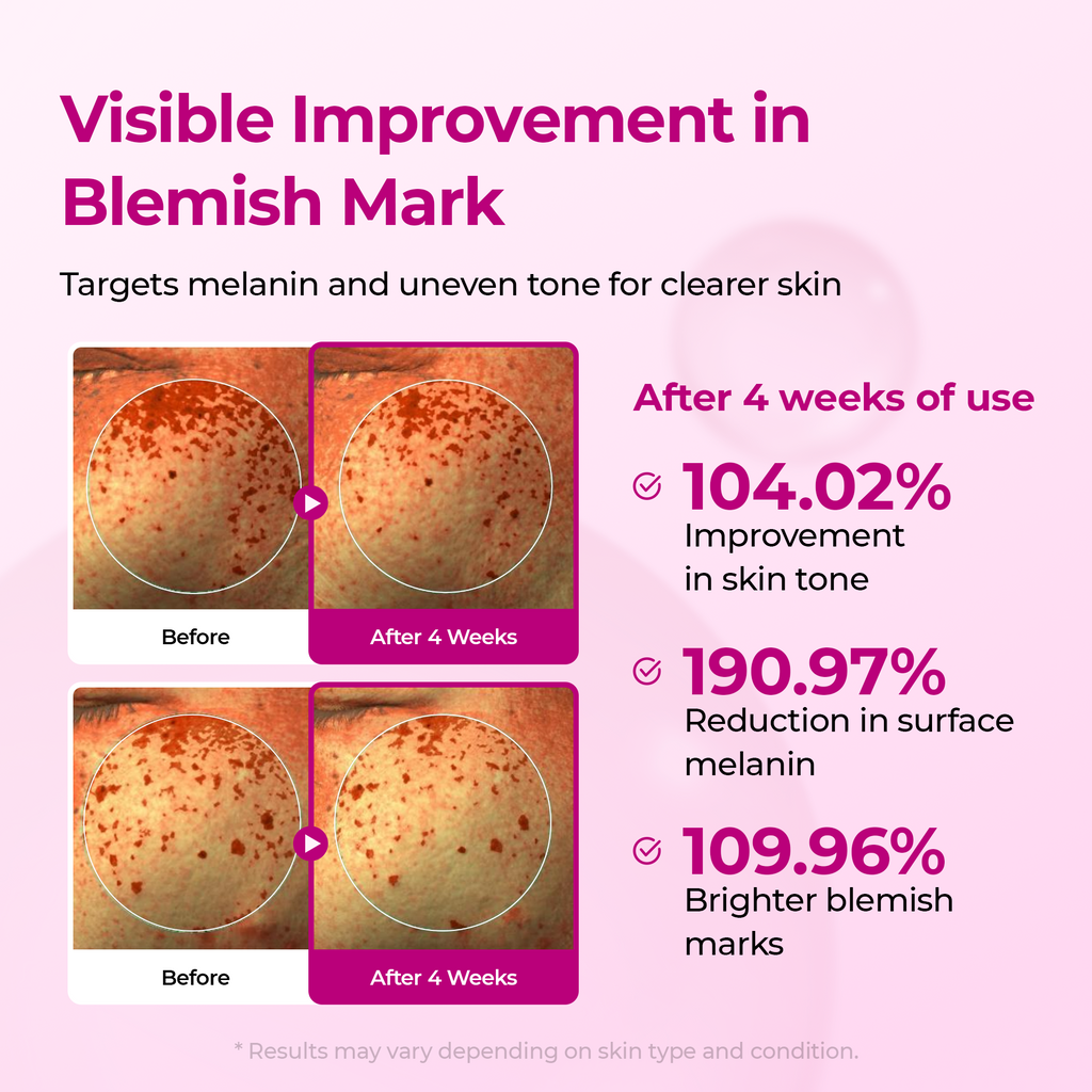 Meesue Lumi Pore & Spot Care Serum Duo Set for Pores, Dark Spots & Pigmentation
