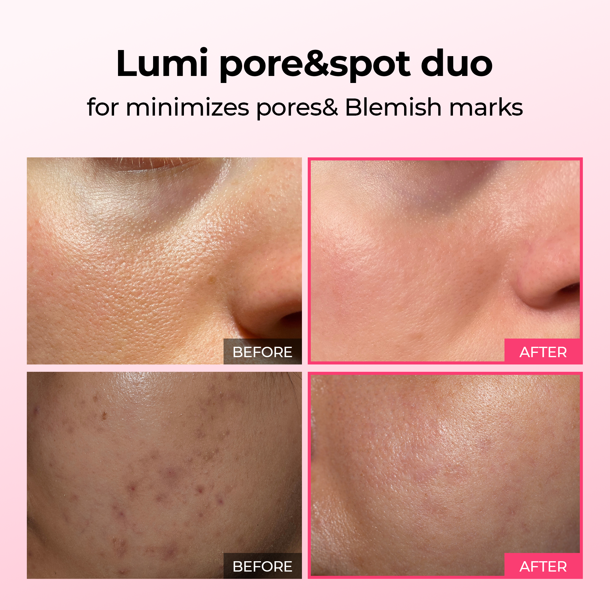 Meesue Lumi Pore & Spot Care Serum Duo Set for Pores, Dark Spots & Pigmentation