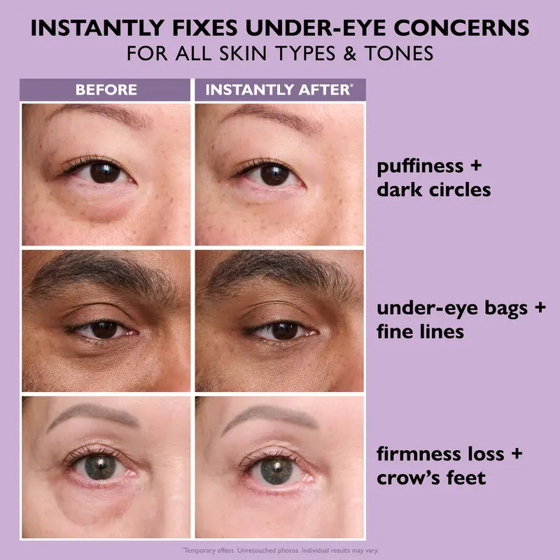 Meesue Eye Tightening Serum with Peptides for Puffiness, Wrinkles & Fine Lines