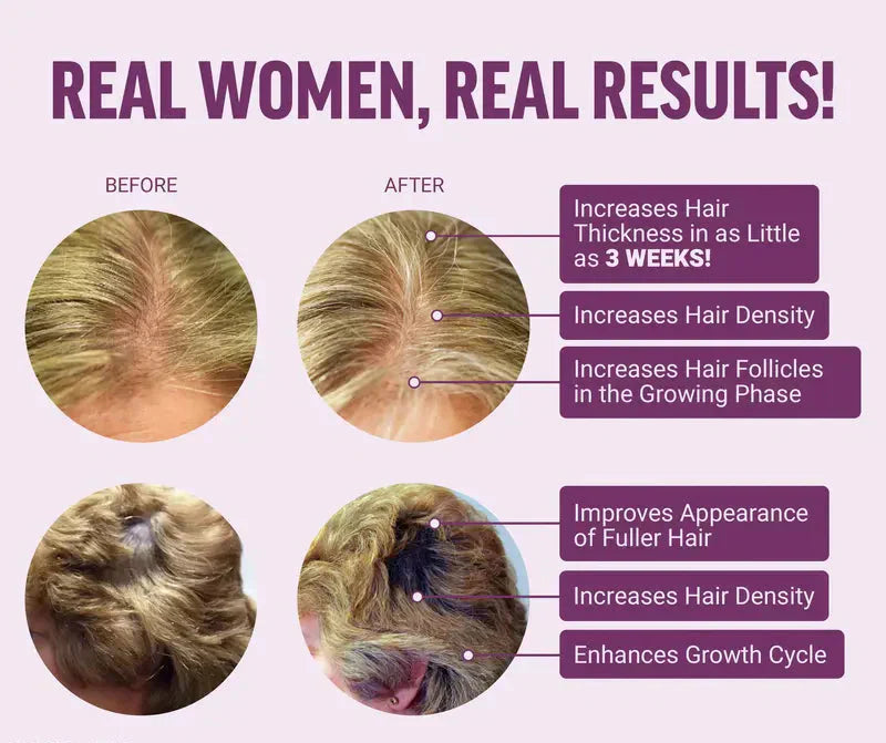 Meesue Hair Growth Accelerator Biotin Supplement with Zinc for Thicker & Fuller Hair